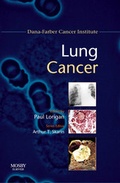 Cover: Lung Cancer - Mosby