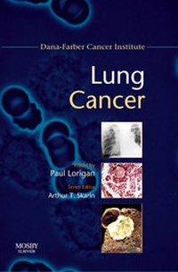 Enlarge image Cover: Lung Cancer - Mosby