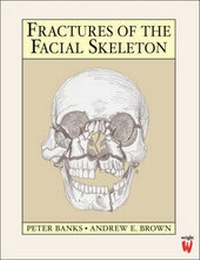 Enlarge image Cover: Fractures of the Facial Skeleton - Butterworth-Heinemann