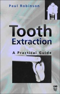 Cover: Tooth Extraction - Butterworth-Heinemann
