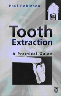Enlarge image Cover: Tooth Extraction - Butterworth-Heinemann