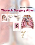 Bild: Thoracic Surgery Atlas - Saunders