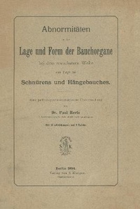 Abbildung von: Abnormitaeten in der Lage und Form der Bauchorgane bei dem erwachsenen Weibe, eine Folge des Schnuerens und Haengebauches - S Karger AG
