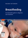 Cover: Breastfeeding - Mosby