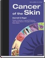 Cover: Cancer of the Skin - Saunders
