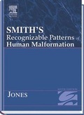 Bild: Smith's Recognizable Patterns of Human Malformation - Saunders