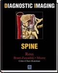 Cover: Spine - Saunders