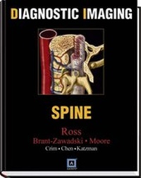 Enlarge image Cover: Spine - Saunders