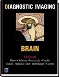 Cover: Brain - Saunders