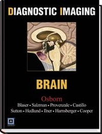 Enlarge image Cover: Brain - Saunders