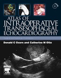 Cover: Atlas of Intraoperative Transesophageal Echocardiography - Saunders