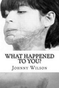 Enlarge image Cover: What Happened to You? - Wilson