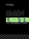 Cover: Color Atlas of Gonioscopy - American Academy of Ophthalmology