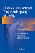 Cover: Charnley Low-Frictional Torque Arthroplasty of the Hip - Springer