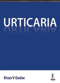 Enlarge image Cover: Urticaria - Jaypee Brothers Medical Publishers