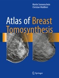 Cover: Atlas of Breast Tomosynthesis - Springer