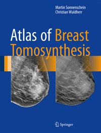 Abbildung von: Atlas of Breast Tomosynthesis - Springer