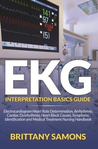 Abbildung von: EKG Interpretation Basics Guide - Mihails Konoplovs