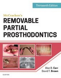 Abbildung von: McCracken's Removable Partial Prosthodontics - Mosby