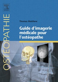 Abbildung von: Guide d'imagerie médicale pour l'ostéopathe - Elsevier
