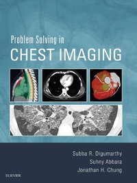 Enlarge image Cover: Problem Solving in Chest Imaging E-Book - Elsevier
