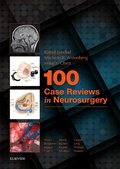 Bild: 100 Case Reviews in Neurosurgery E-Book - Elsevier