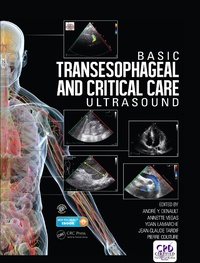 Bild: Basic Transesophageal and Critical Care Ultrasound - CRC Press