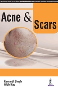 Cover: Acne & Scars - Jaypee Brothers Medical Publishers