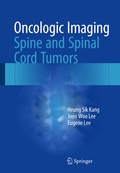 Cover: Oncologic Imaging: Spine and Spinal Cord Tumors - Springer