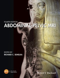 Abbildung von: Abdominal-Pelvic MRI - Wiley-Blackwell