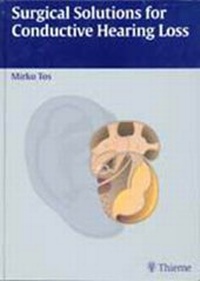 Abbildung von: Volume 4: Surgical Solutions for Conductive Hearing Loss - Thieme