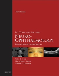 Bild: Liu, Volpe, and Galetta's Neuro-Ophthalmology E-Book - Elsevier