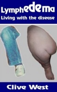 Abbildung von: Lymphedema - Any Subject Books