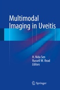 Cover: Multimodal Imaging in Uveitis - Springer