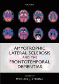 Bild: Amyotrophic Lateral Sclerosis and the Frontotemporal Dementias - OUP Oxford