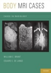 Abbildung von: Body MRI Cases - Oxford University Press, USA