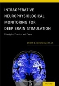 Bild: Intraoperative Neurophysiological Monitoring for Deep Brain Stimulation - OUP eBook