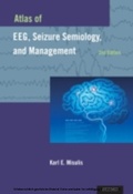 Bild: Atlas of EEG, Seizure Semiology, and Management - OUP eBook