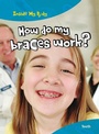 Cover: How do my Braces Work? - Raintree Publishers