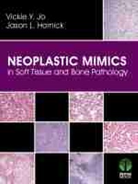 Abbildung von: Neoplastic Mimics in Soft Tissue and Bone Pathology - Demos Medical Publishing