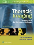 Bild: Thoracic Imaging - Lippincott Williams and Wilkins