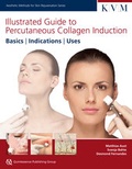 Cover: Illustrated Guide to Percutaneous Collagen Induction - Quintessence Publishing Co Inc.,U.S.