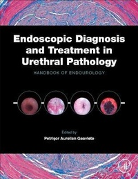 Abbildung von: Endoscopic Diagnosis and Treatment in Urethral Pathology - Academic Press