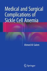 Abbildung von: Medical and Surgical Complications of Sickle Cell Anemia - Springer