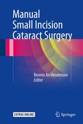 Cover: Manual Small Incision Cataract Surgery - Springer