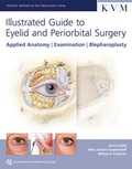 Cover: Illustrated Guide to Eyelid and Periorbital Surgery - Quintessenz Verlags GmbH