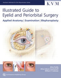 Enlarge image Cover: Illustrated Guide to Eyelid and Periorbital Surgery - Quintessenz Verlags GmbH