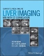 Cover: Liver Imaging - MRI with CT Correlation - Wiley