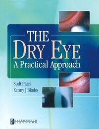 Abbildung von: The Dry Eye - Butterworth-Heinemann