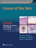 Cover: Cancer of the Skin - Lippincott Williams and Wilkins
